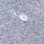 Calcineurin A Antibody in Immunohistochemistry (Paraffin) (IHC (P))