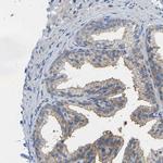 Calcineurin A Antibody in Immunohistochemistry (Paraffin) (IHC (P))