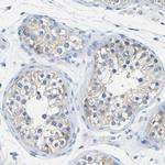 Calcineurin A Antibody in Immunohistochemistry (Paraffin) (IHC (P))
