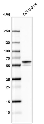 Calcineurin A Antibody in Western Blot (WB)
