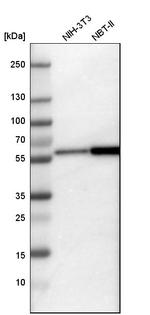 Calcineurin A Antibody in Western Blot (WB)
