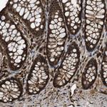 VCP Antibody in Immunohistochemistry (Paraffin) (IHC (P))