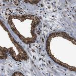 VCP Antibody in Immunohistochemistry (Paraffin) (IHC (P))