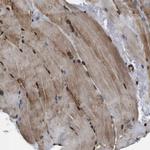 VCP Antibody in Immunohistochemistry (Paraffin) (IHC (P))