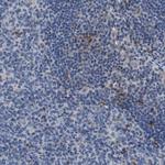 ATP1B1 Polyclonal Antibody