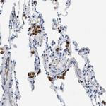 XCR1 Antibody in Immunohistochemistry (Paraffin) (IHC (P))