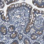 DCP1A Antibody in Immunohistochemistry (Paraffin) (IHC (P))
