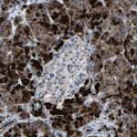 DCP1A Antibody in Immunohistochemistry (Paraffin) (IHC (P))