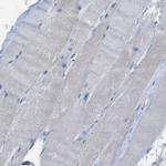 DCP1A Antibody in Immunohistochemistry (Paraffin) (IHC (P))