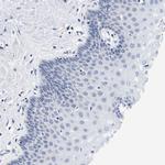 CD42b Polyclonal Antibody