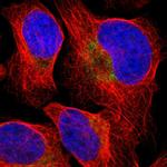 CD273 (B7-DC) Polyclonal Antibody