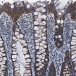 CD273 (B7-DC) Antibody in Immunohistochemistry (Paraffin) (IHC (P))