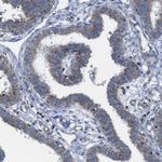 CD273 (B7-DC) Antibody in Immunohistochemistry (Paraffin) (IHC (P))