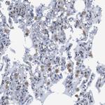 CD273 (B7-DC) Antibody in Immunohistochemistry (Paraffin) (IHC (P))