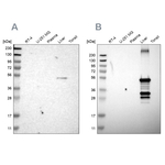 CYP2C8 Antibody in Western Blot (WB)
