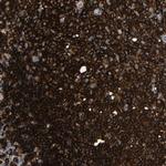 HLA-DQB1 Antibody in Immunohistochemistry (Paraffin) (IHC (P))