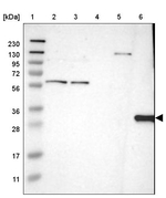 HLA-DQB1 Antibody in Western Blot (WB)