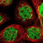 SLITRK5 Polyclonal Antibody