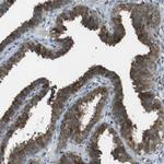 SLITRK5 Antibody in Immunohistochemistry (Paraffin) (IHC (P))