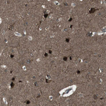 SLITRK5 Antibody in Immunohistochemistry (Paraffin) (IHC (P))
