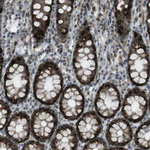 SLITRK5 Antibody in Immunohistochemistry (Paraffin) (IHC (P))