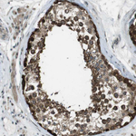 SLITRK5 Antibody in Immunohistochemistry (Paraffin) (IHC (P))