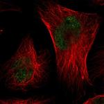 CMTM3 Polyclonal Antibody