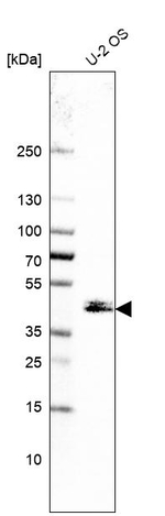 Cytohesin 3 Antibody in Western Blot (WB)