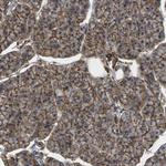 IQGAP1 Antibody in Immunohistochemistry (Paraffin) (IHC (P))