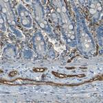 CD39 Antibody in Immunohistochemistry (Paraffin) (IHC (P))