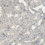 CD39 Antibody in Immunohistochemistry (Paraffin) (IHC (P))