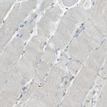 CD39 Antibody in Immunohistochemistry (Paraffin) (IHC (P))