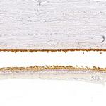 RGS9 Polyclonal Antibody