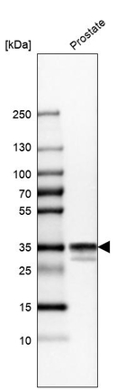 Calponin 1 Antibody in Western Blot (WB)