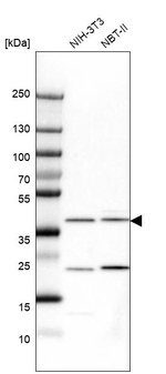 Calponin 1 Antibody in Western Blot (WB)