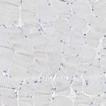 Kallikrein 5 Polyclonal Antibody