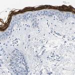 Kallikrein 5 Antibody in Immunohistochemistry (Paraffin) (IHC (P))