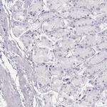 Allergin 1 Antibody in Immunohistochemistry (Paraffin) (IHC (P))
