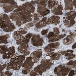 gamma Synuclein Antibody in Immunohistochemistry (Paraffin) (IHC (P))