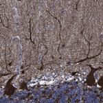 gamma Synuclein Antibody in Immunohistochemistry (Paraffin) (IHC (P))