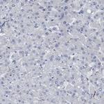 gamma Synuclein Antibody in Immunohistochemistry (Paraffin) (IHC (P))