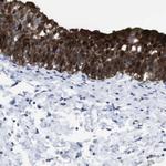 gamma Synuclein Polyclonal Antibody