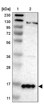 gamma Synuclein Antibody in Western Blot (WB)
