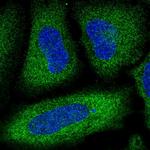 PDE3A Polyclonal Antibody