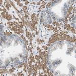 MYH11 Antibody in Immunohistochemistry (Paraffin) (IHC (P))