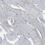 MYH11 Polyclonal Antibody