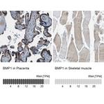 BMP1 Antibody