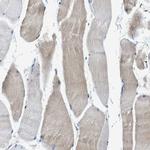 BMP1 Polyclonal Antibody