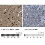 TOM70 Antibody