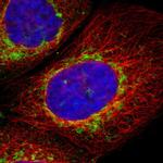 TOM70 Polyclonal Antibody